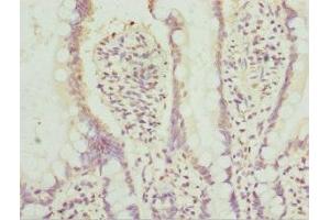 Immunohistochemistry of paraffin-embedded human small intestine tissue using ABIN7142022 at dilution of 1:100 (AGPAT2 抗体  (AA 199-278))