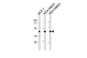 SGCG Antibody (Center) (ABIN1881799 and ABIN2843437) western blot analysis in MCF-7,MDA-M,MDA-M cell line lysates (35 μg/lane). (SGCG 抗体  (AA 145-172))