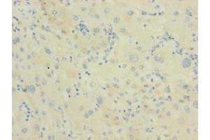 Immunohistochemistry (IHC) image for anti-DnaJ (Hsp40) Homolog, Subfamily B, Member 14 (DNAJB14) (AA 1-244) antibody (ABIN7150510)