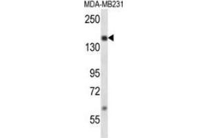 Western Blotting (WB) image for anti-Nuclear Receptor Coactivator 1 (NCOA1) (AA 593-625), (Middle Region) antibody (ABIN953617)