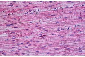 Anti-PPP3CA / Calcineurin A antibody IHC of human intestine, muscularis propria.