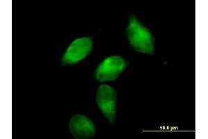 Immunofluorescence of purified MaxPab antibody to SERPINA3 on HeLa cell. (SERPINA3 抗体  (AA 1-423))