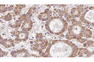 Immunohistochemistry (IHC) image for anti-Olfactory Receptor, Family 4, Subfamily N, Member 2 (OR4N2) antibody (ABIN6263868)