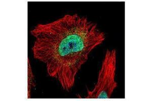 ICC/IF Image Confocal immunofluorescence analysis (Olympus FV10i) of paraformaldehyde-fixed HeLa, using Tankyrase 2, antibody (Green) at 1:500 dilution. (TNKS2 抗体  (N-Term))