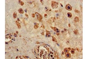 Immunohistochemistry of paraffin-embedded human placenta tissue using ABIN7162445 at dilution of 1:100 (P2RX4 抗体  (AA 91-176))