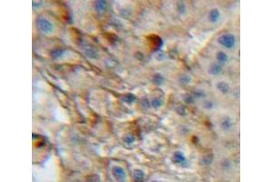 Used in DAB staining on fromalin fixed paraffin-embedded Liver tissue (Integrin alpha 1 抗体  (AA 125-366))