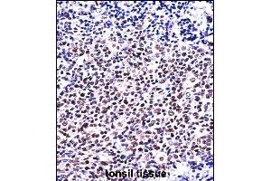 NFATC1 Antibody (C-term) ((ABIN657821 and ABIN2846788))immunohistochemistry analysis in formalin fixed and paraffin embedded human tonsil tissue followed by peroxidase conjugation of the secondary antibody and DAB staining.