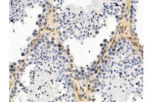 Phospho-Nanog (Thr280) Antibody at 1/100 staining Mouse testis tissue by IHC-P. (Nanog 抗体  (pThr280))