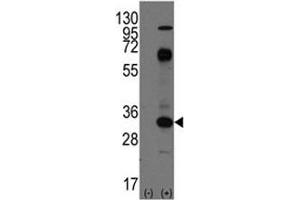Western blot analysis of CD8 antibody and 293 cell lysate (2 ug/lane) either nontransfected (Lane 1) or transiently transfected with the CD8A gene (2). (CD8 alpha 抗体  (AA 150-180))