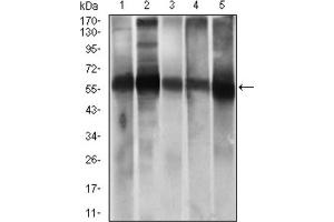 Western Blotting (WB) image for anti-Aldehyde Dehydrogenase 2 Family (Mitochondrial) (ALDH2) (AA 317-517) antibody (ABIN1846467)