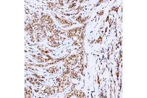IHC analysis of Symplekin/SYMPK using anti-Symplekin/SYMPK antibody (ABIN7601558).
