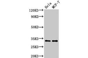 Western Blot Positive WB detected in: Hela whole cell lysate, MCF-7 whole cell lysate All lanes: HIST1H1B antibody at 1. (Histone H1.5 抗体  (pThr154))