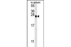 EID2 Antibody (C-term) (ABIN651820 and ABIN2840412) western blot analysis in mouse spleen tissue lysates (15 μg/lane).