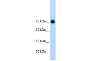 WB Suggested Anti-GTF2IRD1 Antibody Titration:  2. (GTF2IRD1 抗体  (C-Term))