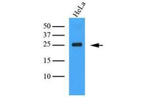 Cell lysates of HeLa (35 ug) were resolved by SDS-PAGE, transferred to nitrocellulose membrane and probed with anti-human MInitrocelluloseLE (1:1000).