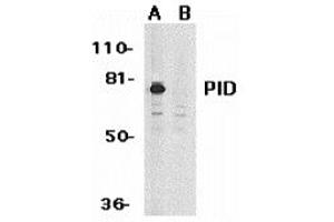 Western blot analysis of PID expression in HeLa whole cell lysates in the absence (A) or presence (B) of blocking peptide with PID antibody at 1 ug /ml. (MTA2 抗体)