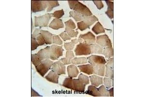 CFB Antibody (Center) (ABIN652979 and ABIN2842621) immunohistochemistry analysis in formalin fixed and paraffin embedded human skeletal muscle followed by peroxidase conjugation of the secondary antibody and DAB staining. (Complement Factor B 抗体  (AA 469-494))