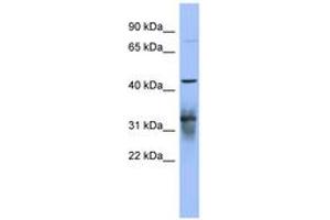 Image no. 1 for anti-Poly(A) Binding Protein, Cytoplasmic 5 (PABPC5) (AA 71-120) antibody (ABIN6743042) (PABPC5 抗体  (AA 71-120))