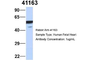 Host: Rabbit   Target Name: 41163   Sample Tissue: Human Fetal Heart  Antibody Dilution: 1. (Septin 11 抗体  (N-Term))