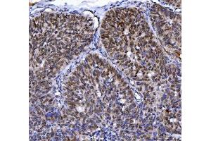 IHC analysis of MLH1 using anti-MLH1 antibody (ABIN7599691). (MLH1 抗体  (AA 108-756))