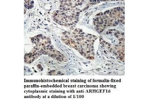 Image no. 1 for anti-rho Guanine Nucleotide Exchange Factor (GEF) 16 (ARHGEF16) antibody (ABIN1574807) (ARHGEF16 抗体)