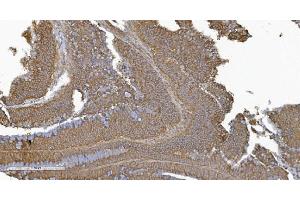 IHC analysis of PLTP using anti-PLTP antibody (ABIN7600346). (PLTP 抗体  (AA 18-470))