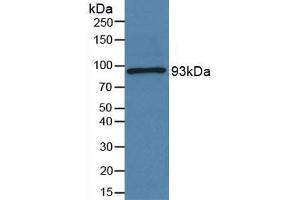 Detection of POSTN in Human Serum using Polyclonal Antibody to Periostin (POSTN) (Periostin 抗体  (AA 97-230))