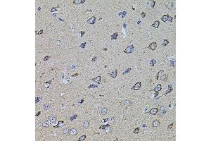 Immunohistochemistry (Paraffin-embedded Sections) (IHC (p)) image for anti-Hyaluronan-Mediated Motility Receptor (RHAMM) (HMMR) (AA 341-440) antibody (ABIN3016223)