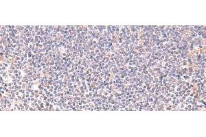 Immunohistochemistry of paraffin-embedded Human tonsil tissue using DHPS Polyclonal Antibody at dilution of 1:75(x200) (DHPS 抗体)