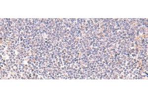 Immunohistochemistry of paraffin-embedded Human tonsil tissue using DHPS Polyclonal Antibody at dilution of 1:75(x200)