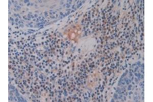 Immunohistochemistry (IHC) image for anti-Hepcidin Antimicrobial Peptide (HAMP) (AA 25-84) antibody (ABIN7427882)