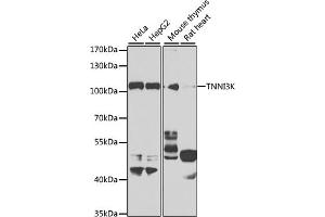 Western blot analysis of extracts of various cell lines, using TNNI3K antibody (ABIN6132847, ABIN6149361, ABIN6149362 and ABIN6223764) at 1:1000 dilution. (TNNI3K 抗体  (AA 1-75))