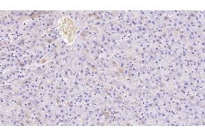Detection of APOH in Human Liver Tissue using Monoclonal Antibody to Apolipoprotein H (APOH) (APOH 抗体  (AA 22-345))
