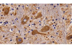 Detection of CHRM1 in Rat Spinal cord Tissue using Polyclonal Antibody to Cholinergic Receptor, Muscarinic 1 (CHRM1) (CHRM1 抗体  (AA 210-363))