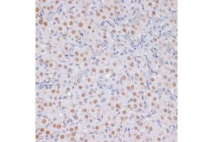 Immunohistochemistry (IHC) image for anti-Histone 3 (H3) (H3K27me) antibody (ABIN6219521)