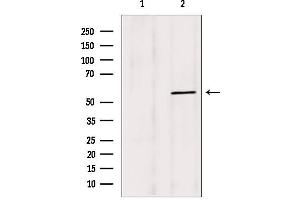 Western blot analysis of extracts from mouse brain, using BBS4 antibody. (BBS4 抗体  (Internal Region))
