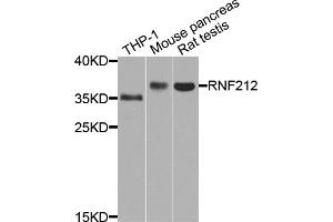 Western blot analysis of extracts of various cell lines, using RNF212 antibody (ABIN5971848) at 1/1000 dilution. (RNF212 抗体)