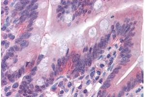 Human Small Intestine: Formalin-Fixed, Paraffin-Embedded (FFPE) (GSDMD 抗体  (AA 1-485))