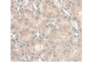 IHC-P analysis of Rat Kidney Tissue, with DAB staining. (Androgen Receptor 抗体  (AA 491-679))