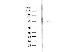 Western blot analysis of lysates from HUVEC cells(UV,30 min treatment), using CST Antibody at 1/1000 dilution.