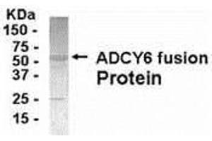 Western Blotting (WB) image for anti-Adenylate Cyclase 6 (ADCY6) (AA 1-121) antibody (ABIN2467944) (ADCY6 抗体  (AA 1-121))