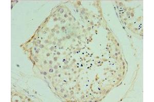 Immunohistochemistry of paraffin-embedded human testis tissue using ABIN7175475 at dilution of 1:100 (VAMP2 抗体  (AA 1-94))