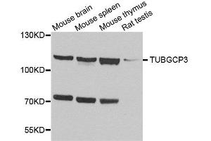 Western blot analysis of extracts of various cell lines, using TUBGCP3 antibody. (TUBGCP3 抗体  (AA 1-250))