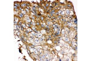 Immunohistochemistry (Paraffin-embedded Sections) (IHC (p)) image for anti-Fibroblast Growth Factor Receptor 4 (FGFR4) (AA 22-206) antibody (ABIN3042391) (FGFR4 抗体  (AA 22-206))