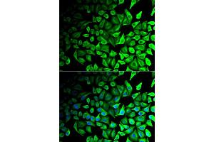 Immunofluorescence analysis of HeLa cells using DPP7 antibody (ABIN5973952). (DPP7 抗体)
