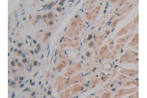 Immunohistochemistry (IHC) image for anti-Basigin (Ok Blood Group) (BSG) (AA 79-280) antibody (ABIN7433759)