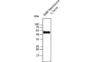Western Blotting (WB) image for anti-SARS-CoV-2 Membrane Protein (SARS-CoV-2 M) (C-Term) antibody (ABIN7273010) (SARS-CoV-2 Membrane Protein 抗体  (C-Term))