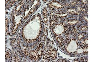 Image no. 5 for anti-Prostaglandin E Synthase 2 (PTGES2) antibody (ABIN1500491)