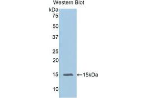 Western blot analysis of the recombinant protein. (IL-15 抗体  (AA 49-162))