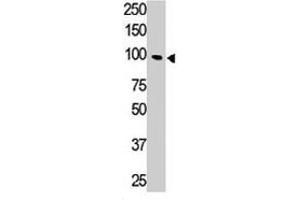 The Tlr5 polyclonal antibody  is used in Western blot to detect TLR5 in HL-60 cell lysate. (TLR5 抗体  (N-Term))